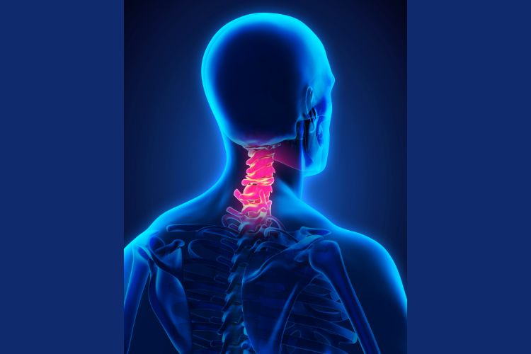 Where Upper Cervical Chiropractic Comes In